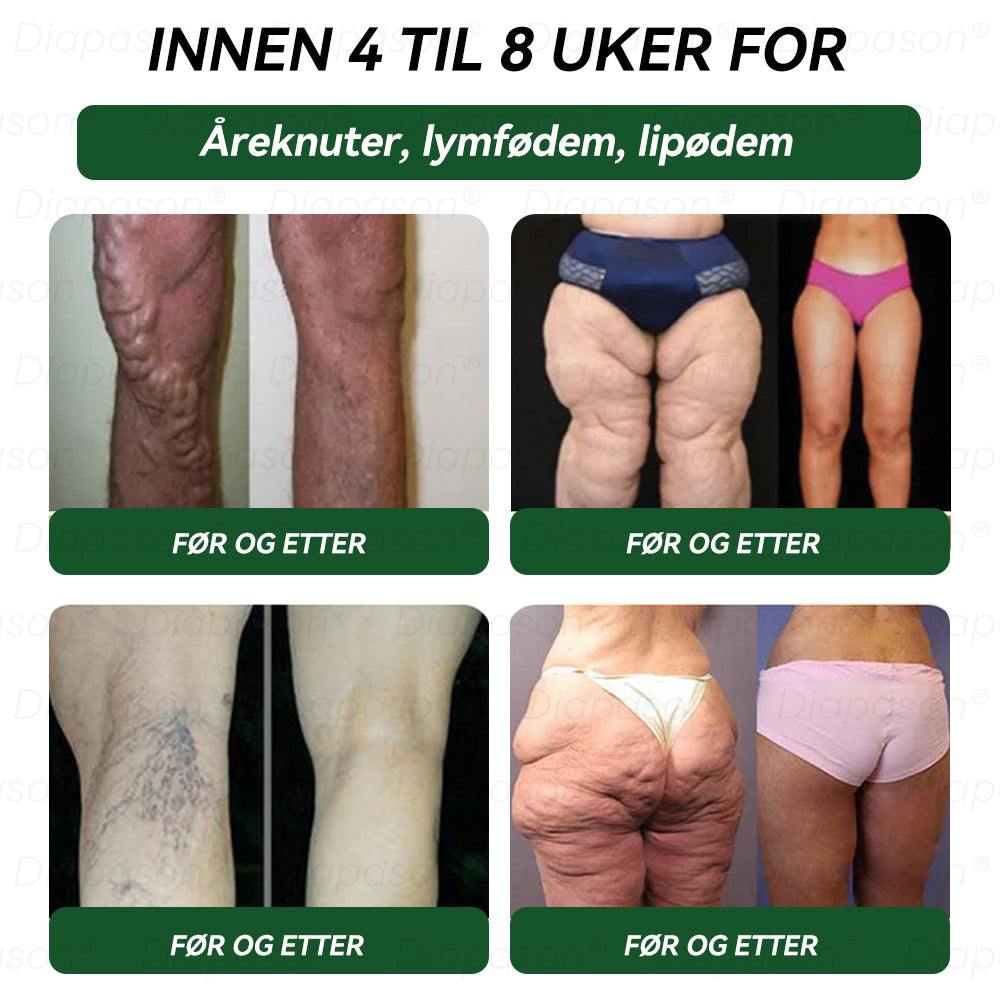 Offisiell butikk | 𝐃𝒊𝓪𝐩𝓪𝙨𝐨𝒏®𝐺𝐿𝑃-1 9 𝐼 1 𝐻𝑒𝑙𝑠𝑒𝑙ø𝑠𝑛𝑖𝑛𝑔 𝑂𝑟𝑎𝑙𝑣æ𝑠𝑘𝑒—— 𝐹𝑜𝑟𝑚𝑒𝑙 𝑓𝑜𝑟 𝑓𝑜𝑟𝑒𝑏𝑦𝑔𝑔𝑖𝑛𝑔 𝑎𝑣 𝑘𝑟𝑜𝑛𝑖𝑠𝑘 𝑠𝑦𝑘𝑑𝑜𝑚(UPSELL)