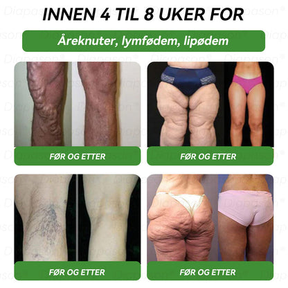 𝑶𝒇𝒇𝒊𝒔𝒊𝒆𝒍𝒍 𝒃𝒖𝒕𝒊𝒌𝒌 | 𝐃𝒊𝓪𝐩𝓪𝙨𝐨𝒏® 𝐺𝐿𝑃-1 𝑆𝑗𝑢 𝑖 é𝑛 ℎ𝑒𝑙𝑠𝑒𝑜𝑝𝑝𝑙ø𝑠𝑛𝑖𝑛𝑔, 𝑜𝑟𝑎𝑙 𝑣æ𝑠𝑘𝑒🎃🎃𝐁𝐚𝐫𝐞 é𝐧 𝐠𝐚𝐧𝐠 𝐨𝐦 𝐝𝐚𝐠𝐞𝐧, 𝐬𝐲𝐧𝐥𝐢𝐠𝐞 𝐫𝐞𝐬𝐮𝐥𝐭𝐚𝐭𝐞𝐫 𝐩å 𝟕 𝐝𝐚𝐠𝐞𝐫 ☘️